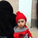 Yemen war results in starvation death for 85,000+ children less than 5 years old