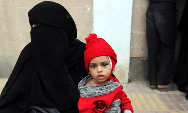 Yemen war results in starvation death for 85,000+ children less than 5 years old